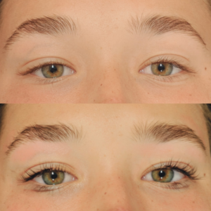 lashlift-square